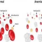 Svolta cura anemia mediterranea: chirurgia chimica su DNA elimina talassemia
