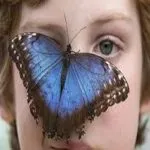 Sindrome Bambino Farfalla o malattia epidermolisi bollosa, che cos’è e quali sono sintomi e cure