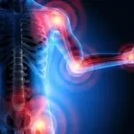 L’artrosi, come combatterla