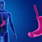 Reflusso gastroesofageo, dieta e stile di vita: cause, sintomi e soluzioni