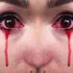 Piange lacrime di sangue: 52enne è un caso clinico