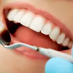 Igiene orale, lavarsi i denti dopo mangiato? 3 falsi miti sulla salute dei denti
