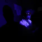 Degenerazione dell'occhio, cause e rimedi