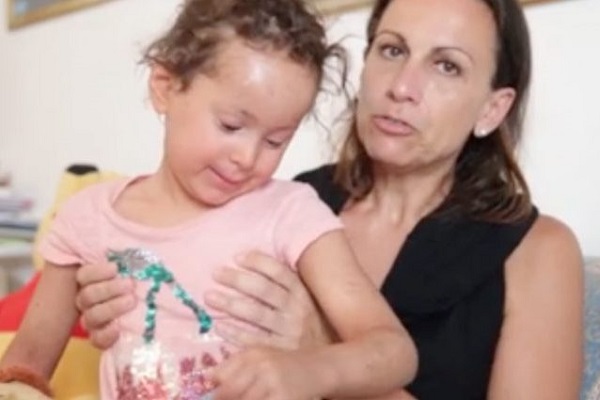 Ittiosi lamellare cos'è e come si trasmette