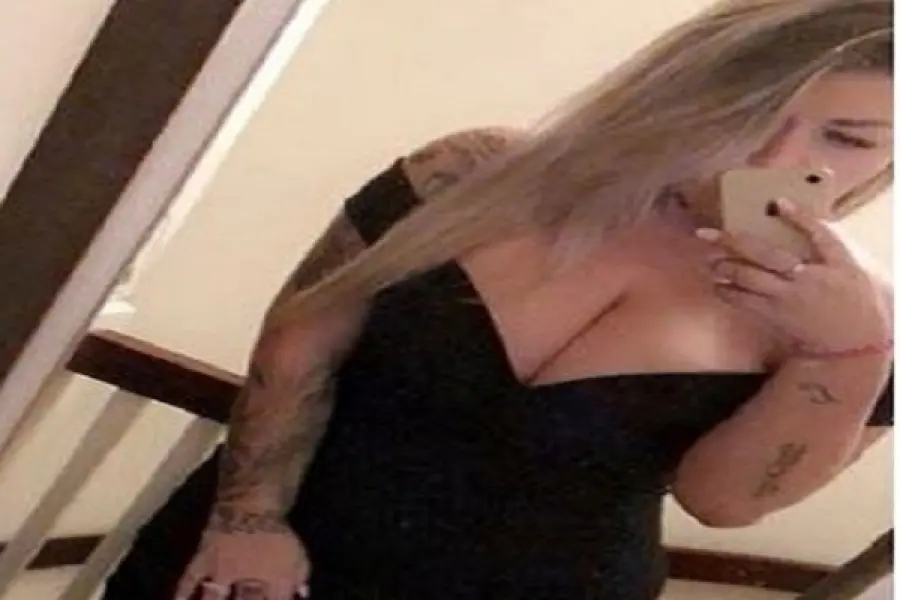 Seno rifatto sciolto dall'acqua bollente, il racconto di una modella inglese