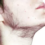 Peluria che cambia nel tempo, ecco perché tutti vogliono abolirla