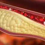 Colesterolo alto: c'è un'alimentazione che lo tiene sotto controllo?