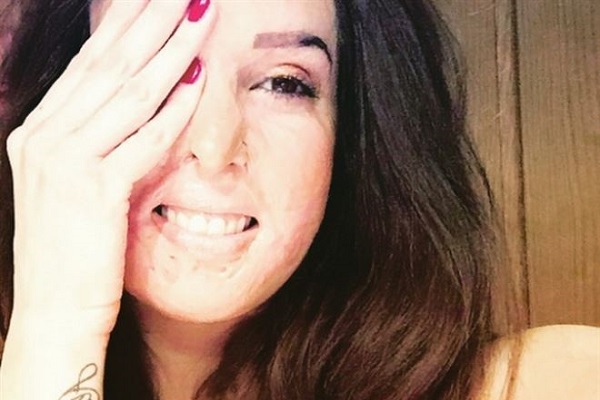 Miss sfregiata con l'acido partecipa a Ballando con le stelle?