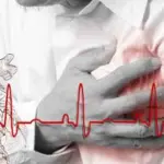 Scoperto un nuovo fattore di rischio infarto: aumenta la possibilità del 50%