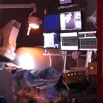 Robot usato a Torino per l'asportazione di cellule malate. E' la prima volta