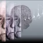 Alzheimer, ansia primo indicatore della malattia
