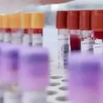 Meningite, sospetto contagio a Battipaglia