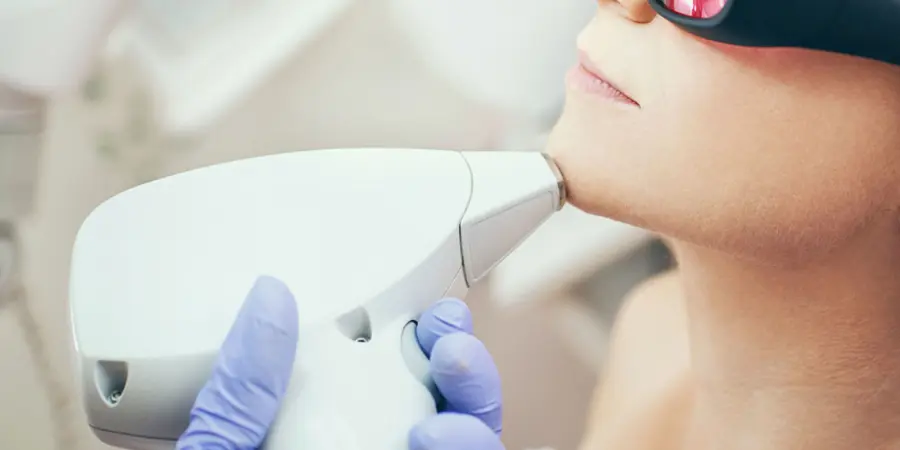 Pro e contro dell’epilazione laser