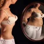 Anoressia e obesità sono collegate alla depressione