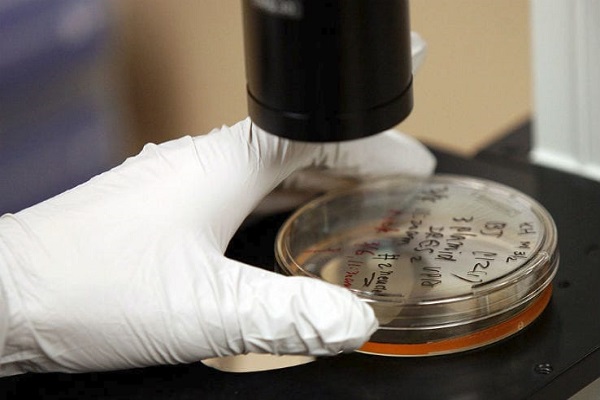 Prevotella, il batterio che cura la sclerosi multipla