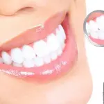 Aspettativa di vita e perdita di denti: legame nascosto, l’avvertimento degli esperti