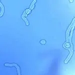 Mosche negli occhi, è possibile eliminarle? Intervento rivoluzionario