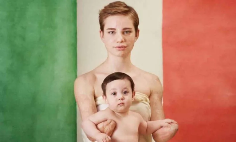 Beatrice Vio Foto Dolcissima di Anne Geddes Per La Campagna In Favore Della Vaccinazione Contro La Meningite