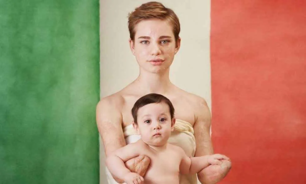 Beatrice Vio Foto Dolcissima di Anne Geddes Per La Campagna In Favore Della Vaccinazione Contro La Meningite