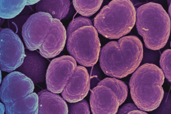 Gonorrea resistente agli antibiotici: nuovi farmaci per la malattia sessuale