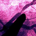 Ridurre il rischio di infarto e ictus