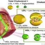 Colesterolo buono si trasforma in cattivo: lo studio shock