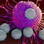 Tumore al colon, individuata proteina “bersaglio” per combattere il cancro