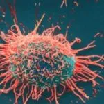 Tumore alla prostata: scoperto enzima che blocca lo sviluppo delle metastasi