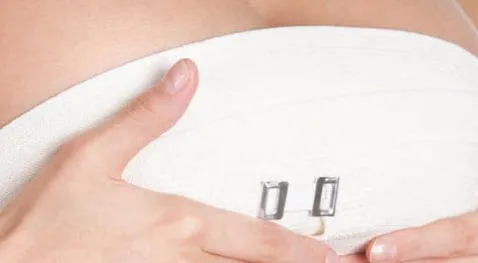 Pap flap, prima ricostruzione di seno con lembi di pelle in Italia