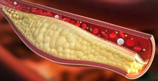 Colesterolo alto: c’è un’alimentazione che lo tiene sotto controllo?