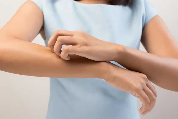 Nuova cura per la psoriasi, test su 1700 pazienti