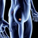 Tumore alla prostata: quando conta davvero sottoporsi alla risonanza magnetica?