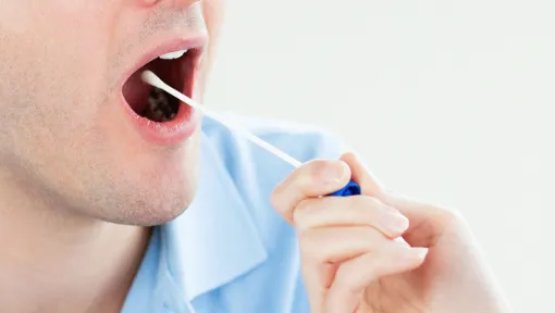 Tumore alla prostata, possibile il test sulla saliva